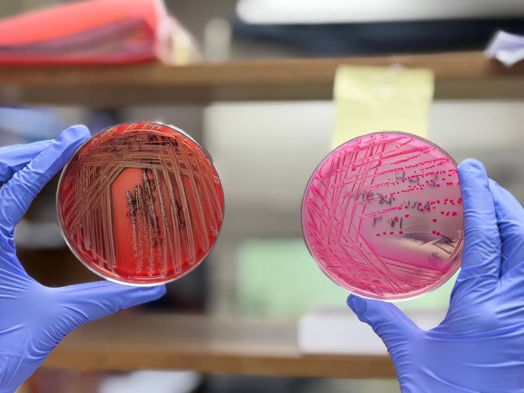 Plates that make the invisible, visible.Media plates are often the start of your sample’s journe
